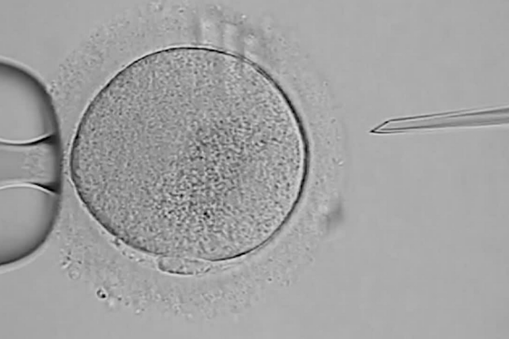 Befruchtung der Eizelle bei IVF Naturelle / Mini IVF