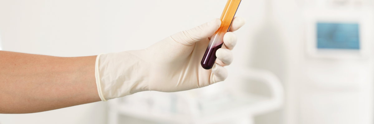 Ärztin bereitet Blut für eine PRP-Behandlung bei unerfülltem Kinderwunsch 