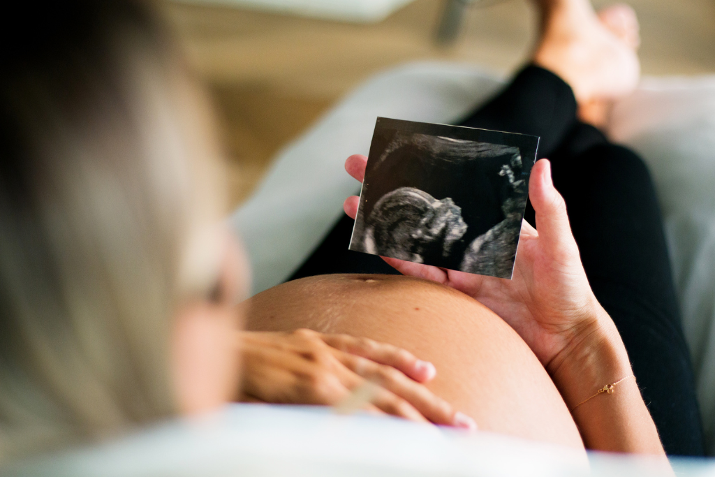 Schwangere Frau betrachtet ein Ultraschallbild ihres Embryos, während sie liebevoll ihren Bauch hält